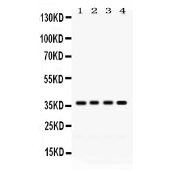 FOXA3 Antibody (aa291-324)
