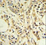 RPS13 / Ribosomal Protein S13 Antibody (aa82-110)