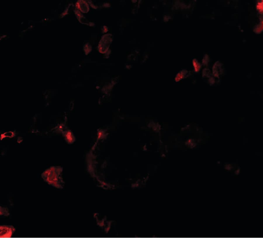 VKORC1 Antibody