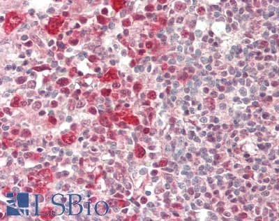 IHC-plus™ HSPA8 / HSC70 Antibody (Internal, clone 6C7)