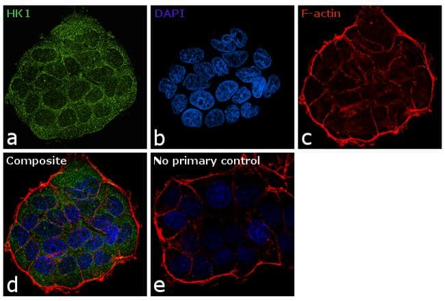 HK1 / Hexokinase 1 Antibody (clone 3A10)