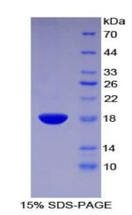 Human GMFG Protein (Recombinant His-T7)