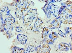 GC / Vitamin D-Binding Protein Antibody (aa305-474)