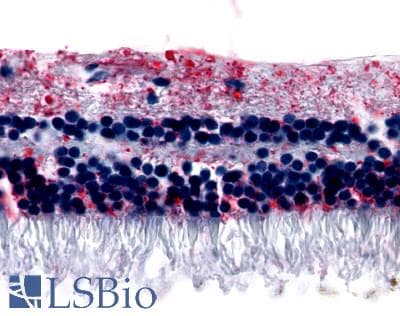 PathPlus™ GRM6 / MGLUR6 Antibody (N-Terminus)