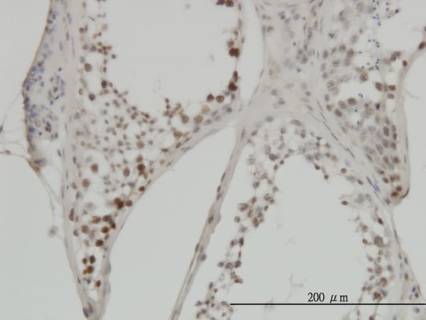Monoclonal Mouse anti-Human MYC / c-Myc Antibody (clone 1G7, IHC, WB)