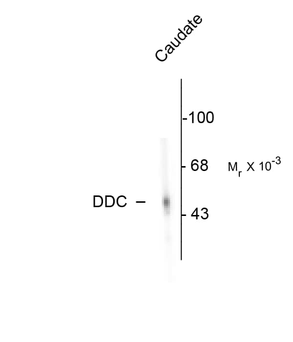 Polyclonal Rabbit anti-Bovine DDC / DOPA Decarboxylase Antibody (WB)