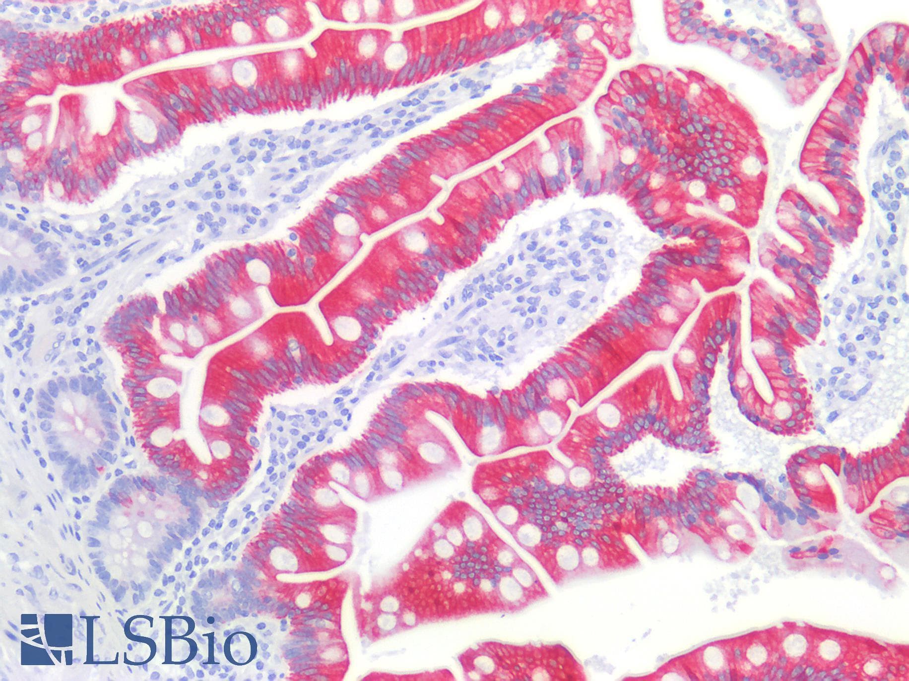 IHC-plus™ KRT20 / CK20 / Cytokeratin 20 Antibody (clone KS 20.8)