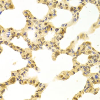 POLB / DNA Polymerase Beta Antibody