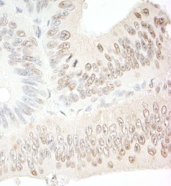 SDE2 / C1orf55 Antibody (aa350-400)