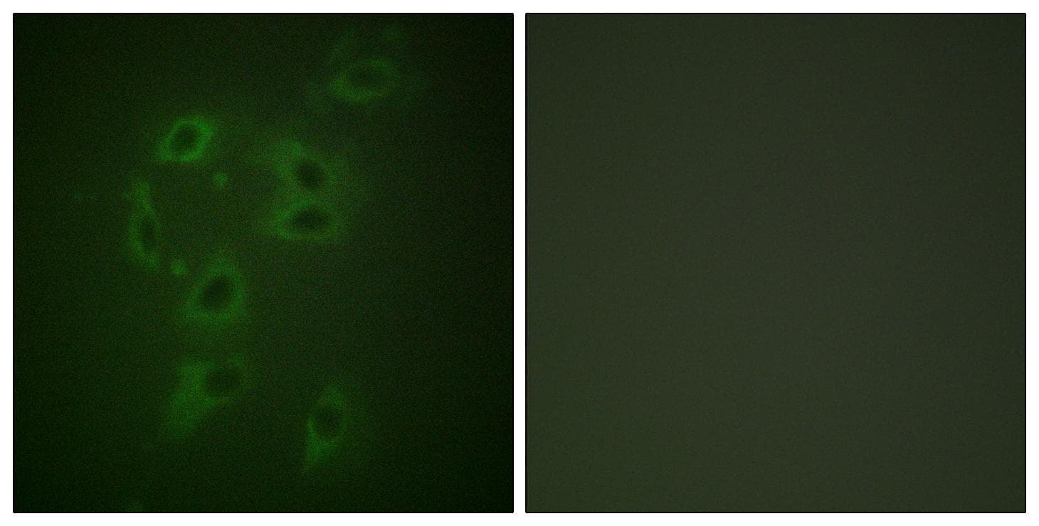 c-CBL Antibody (phospho-Tyr700)