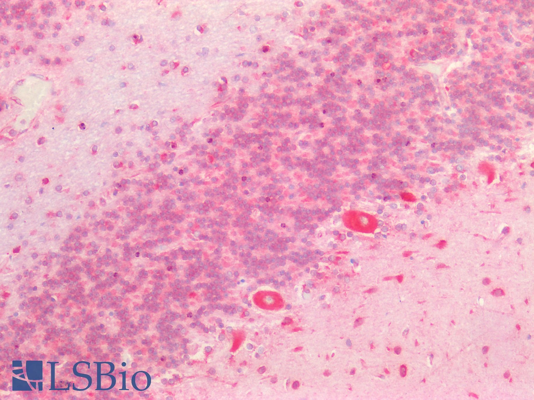 IHC-plus™ Polyclonal Rabbit anti-Human HTR2C / 5-HT2C Receptor Antibody (aa400-450, IHC, IF, WB)
