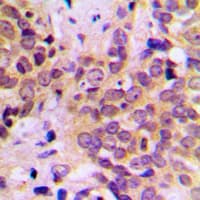 Polyclonal Rabbit anti-Human GSK3B / GSK3 Beta Antibody (N-Terminus, IHC, WB)