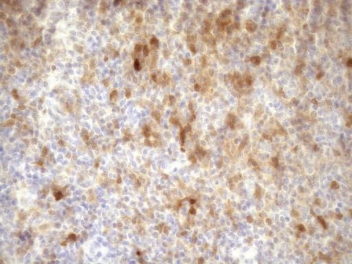 p16INK4a / CDKN2A Antibody (clone OTI1H3)