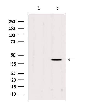 AGPAT3 Antibody