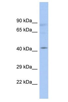 RAD9B Antibody (aa239-288)
