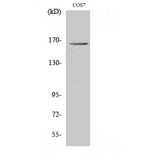 MYOM2 / Myomesin 2 Antibody (590-670 aa, Internal)