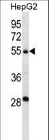 Polyclonal Rabbit anti-Human TMPRSS13 / MSP Antibody (aa431-460, IHC, WB)