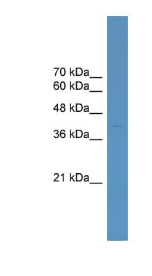 ELK4 Antibody (C-Terminus)