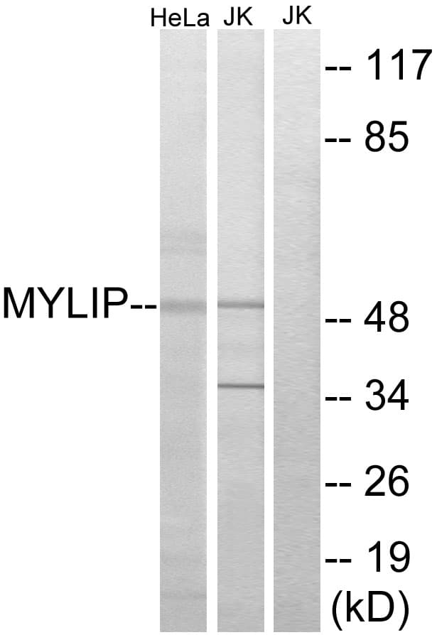 Polyclonal Rabbit anti-Human MYLIP / IDOL Antibody (aa161-210, IHC, WB)