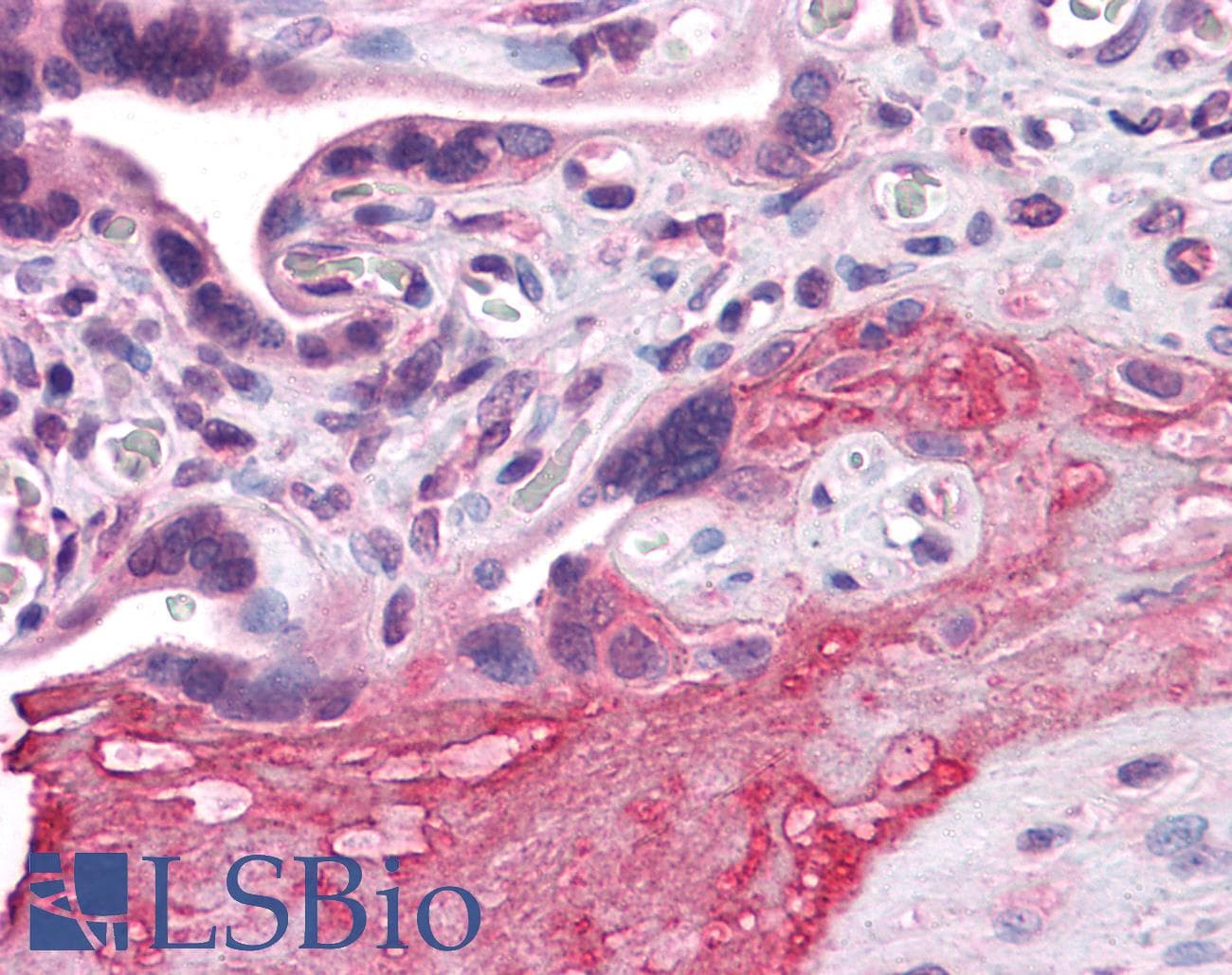 IHC-plus™ ADAM17 / TACE Antibody (clone 1F6)