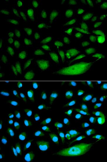 SMAD1 Antibody