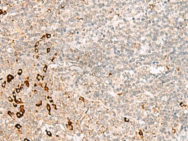 Polyclonal Rabbit anti-Human RMND5A Antibody (IHC)