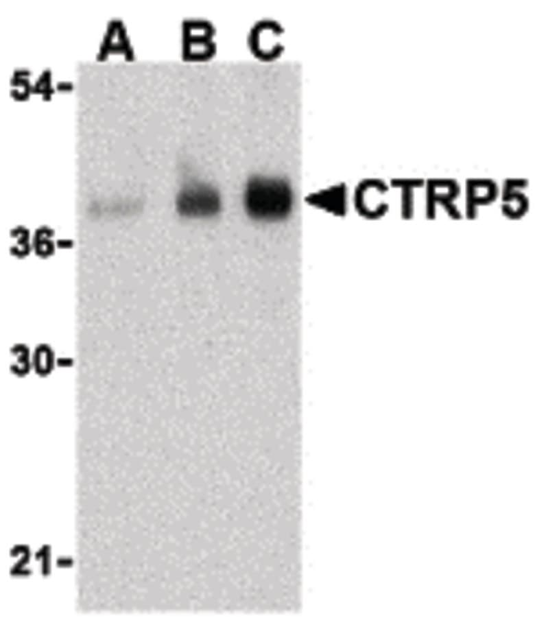 IHC-plus™ C1QTNF5 / CTRP5 Antibody