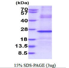 Human IGLL1 / CD179b Protein (Recombinant His)