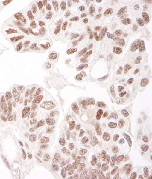 HDAC2 Antibody (aa425-C-term)