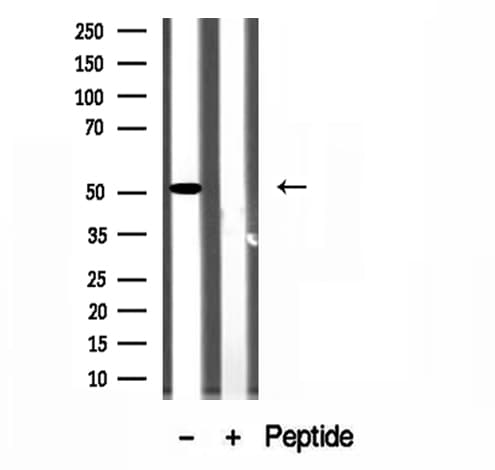 Polyclonal Rabbit anti-Human SLC30A6 Antibody (IHC, WB)