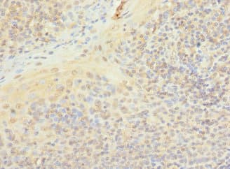 PIP5K1A Antibody
