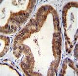 SHQ1 Antibody (aa58-86)