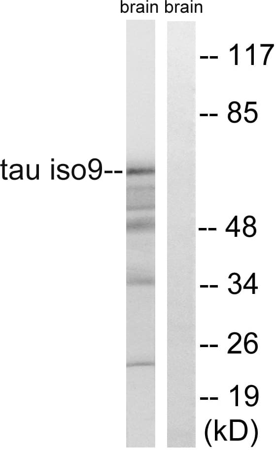 Polyclonal Rabbit anti-Human MAPT / Tau Antibody (aa366-415, WB)