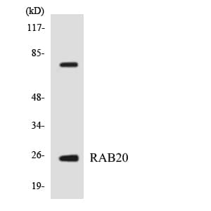 RAB20 Antibody (aa99-148)