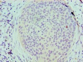 SERPINB5 / Maspin Antibody (aa21-189)