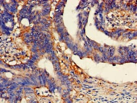 LIMPII / SCARB2 Antibody