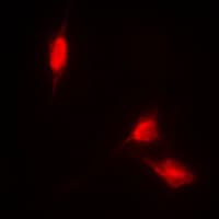 Polyclonal Rabbit anti-Human NFE2L2 / NRF2 Antibody (C-Terminus, IHC, IF, WB)