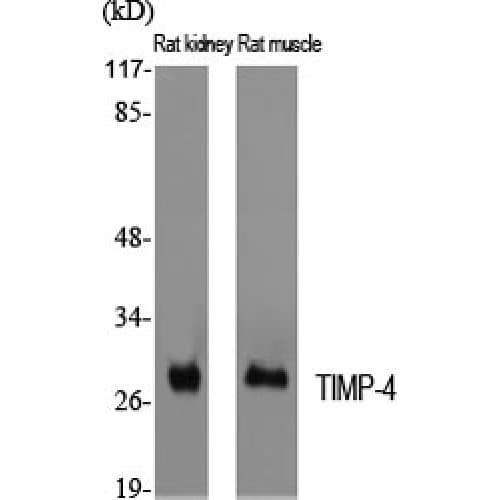 Polyclonal Rabbit anti-Human TIMP4 Antibody (150-230 aa, C-terminal, IHC, WB)