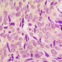 RPS6 / Ribosomal Protein S6 Antibody (C-Terminus)