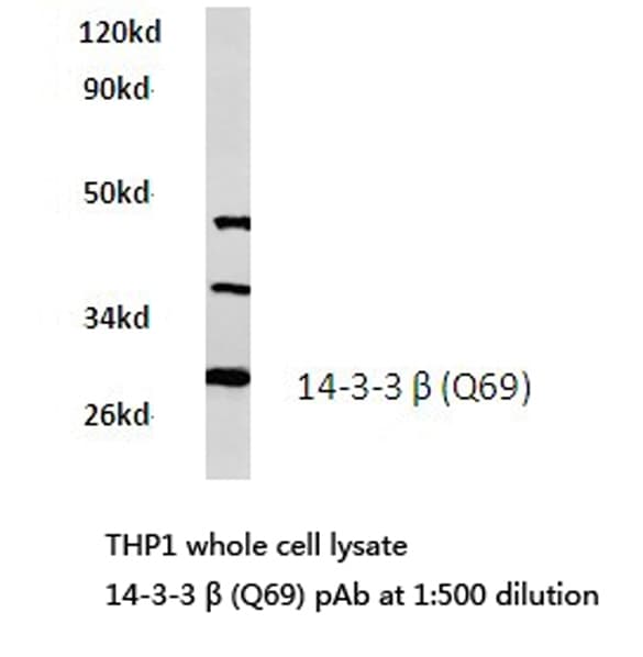 Polyclonal Rabbit anti-Human YWHAB / 14-3-3 Beta Antibody (Gln69, IHC, IF, WB)