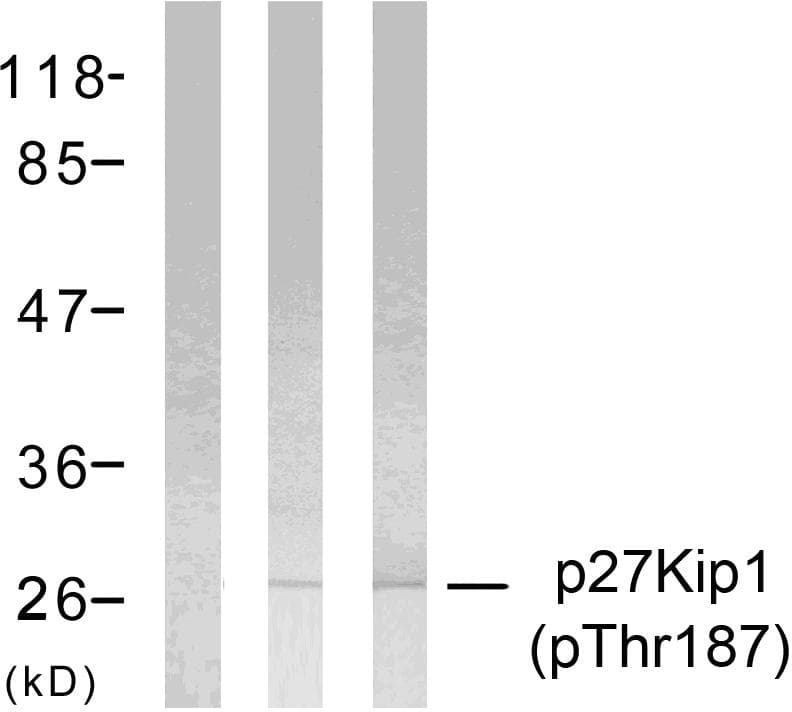 CDKN1B / p27 Kip1 Antibody (phospho-Thr187)