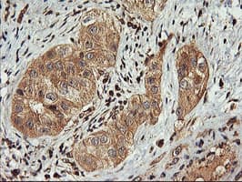 FBXO21 Antibody (clone OTI2C7)