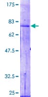 Human AGK Protein (Recombinant GST)