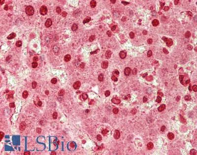 IHC-plus™ Polyclonal Rabbit anti-Human Arkadia / RNF111 Antibody (aa889-938, IHC, WB)