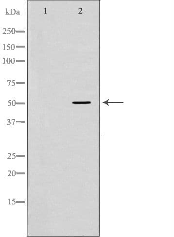 Properdin / CFP Antibody
