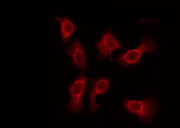 Polyclonal Rabbit anti-Human SVOP Antibody (IF, WB)