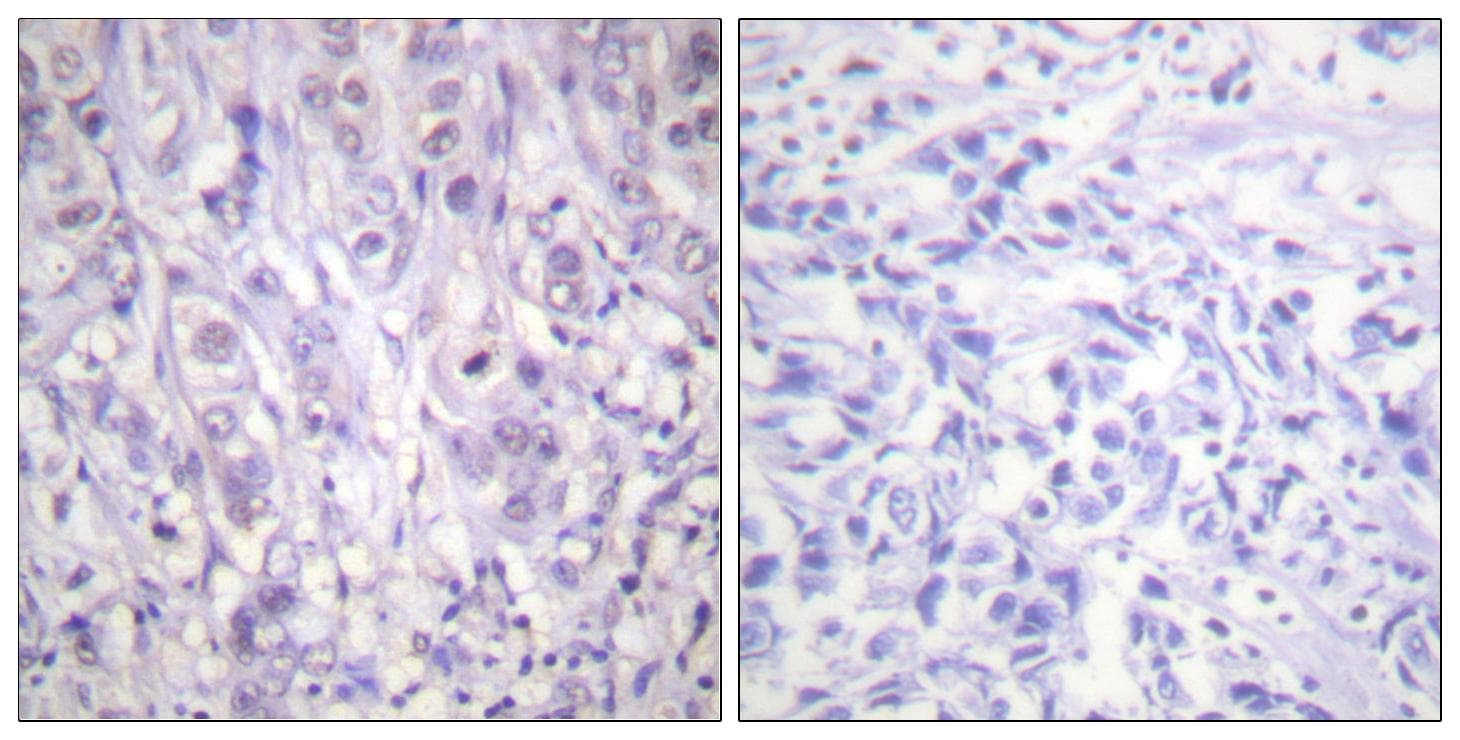 NPM1 / NPM / Nucleophosmin Antibody (phospho-Thr199)