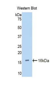 CUBN / Cubilin Antibody (aa3511-3623)