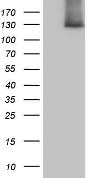 SUPT16H / FACTP140 Antibody (aa187-282, clone OTI8A1)