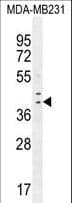 IRF1 / MAR Antibody (aa260-286)